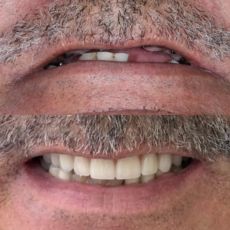 Antes e depois de paciente da clínica, caso 10