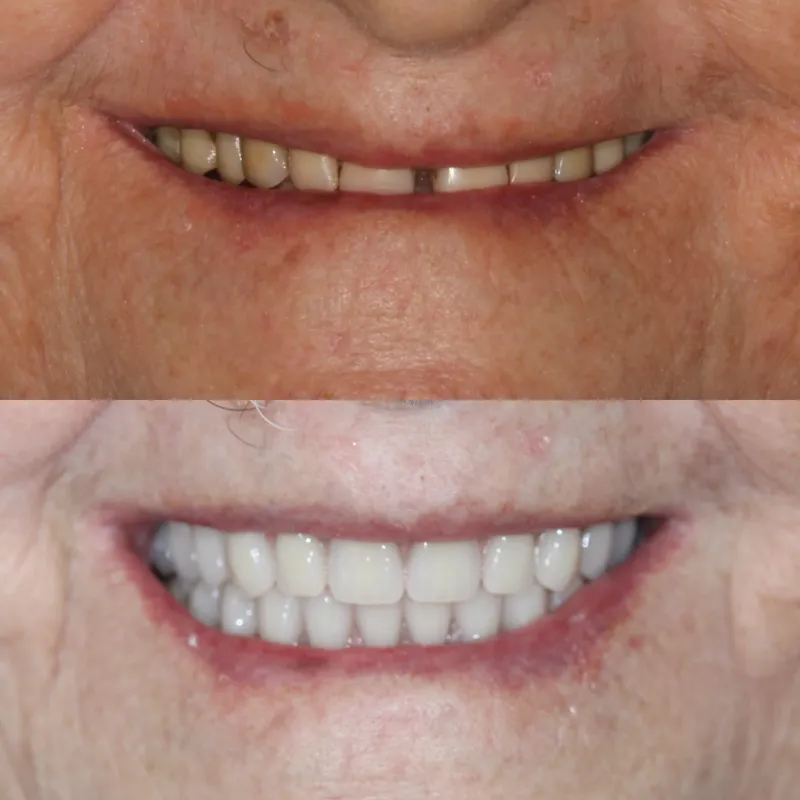 Antes e depois de paciente da clínica, caso 11
