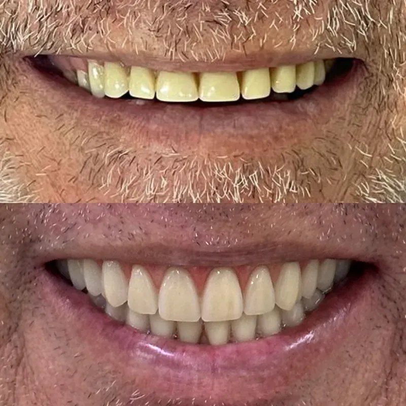 Antes e depois de paciente da clínica, caso 12