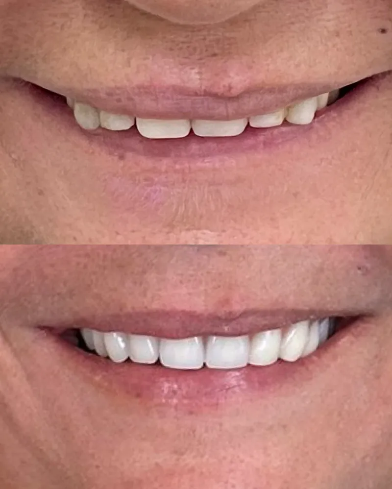 Antes e depois de paciente da clínica, caso 4