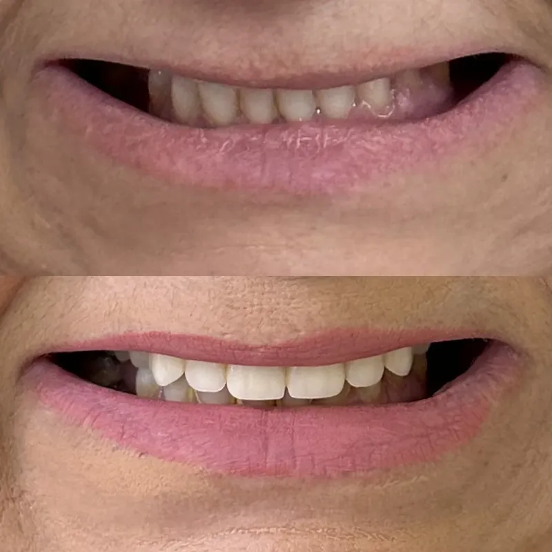Antes e depois de paciente da clínica, caso 6