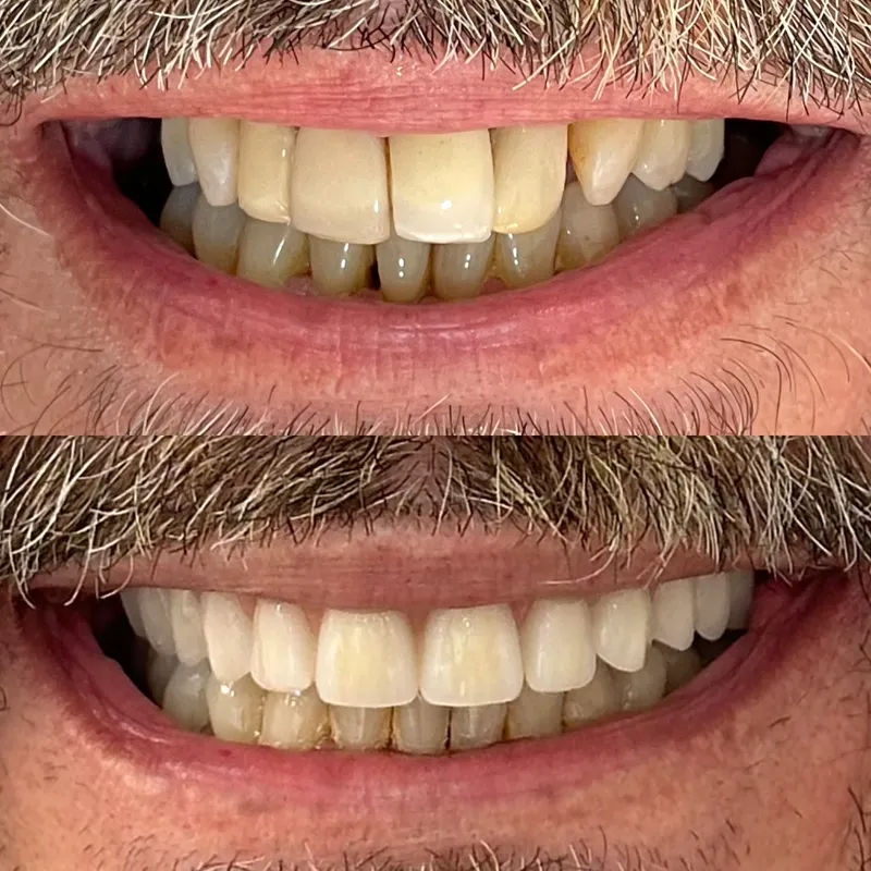 Antes e depois de paciente da clínica, caso 7