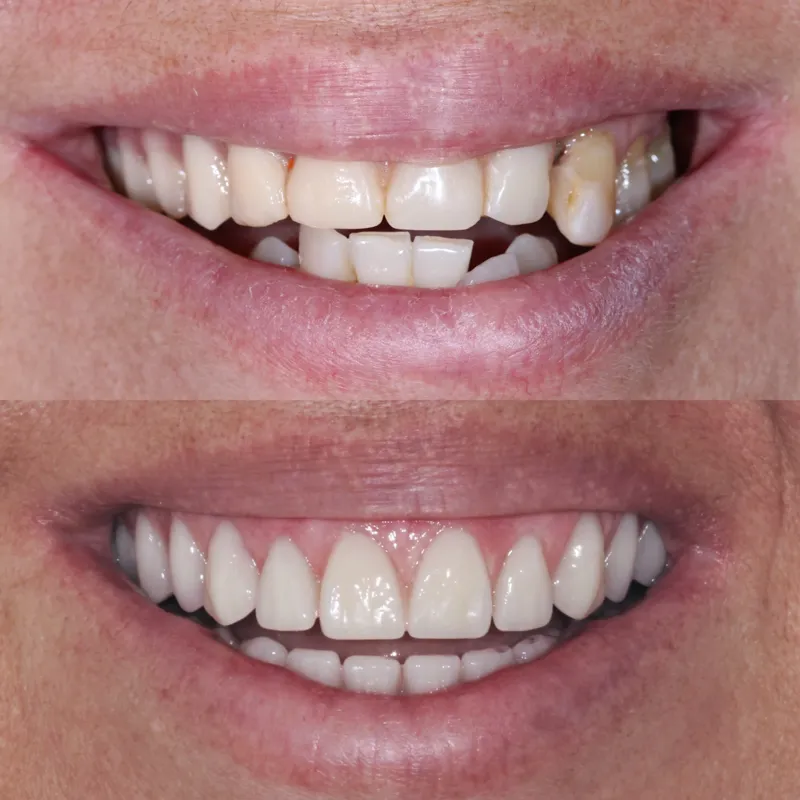 Antes e depois de paciente da clínica, caso 8