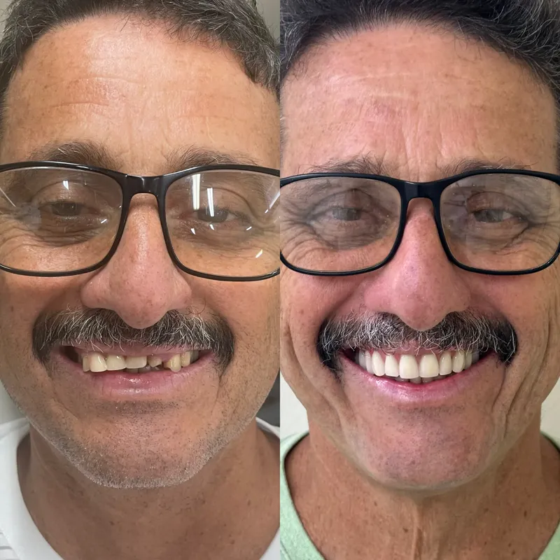 Antes e depois de paciente da clínica, caso 9